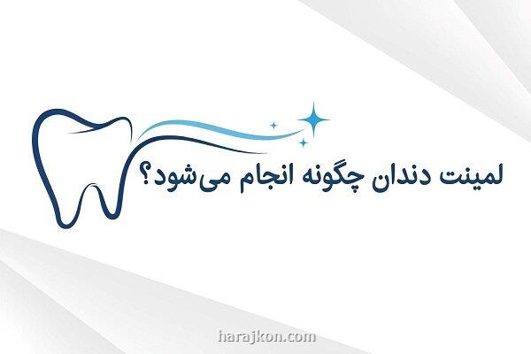 لمینت دندان چگونه به انجام می رسد و مناسب چه کسانی است؟